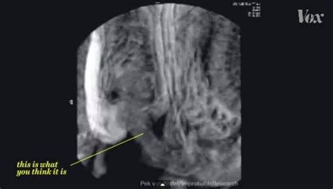 shooting sperm|An inside view of sex: MRI scanner captures intercourse as you。